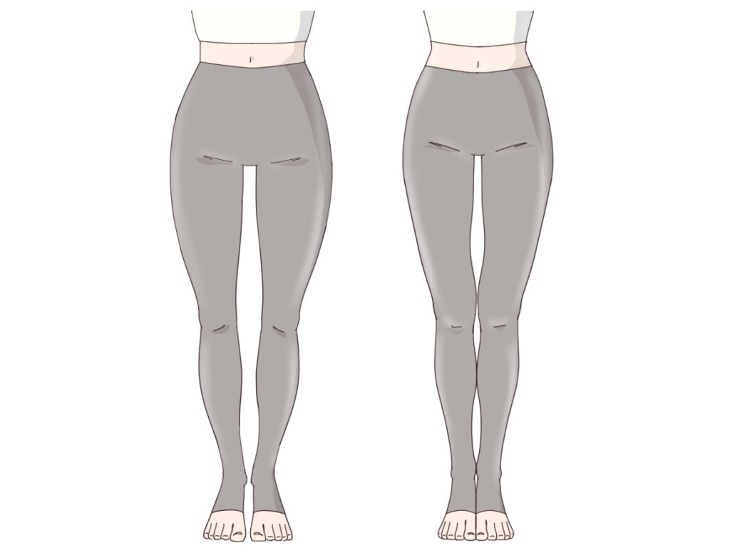 O脚の足のイラスト